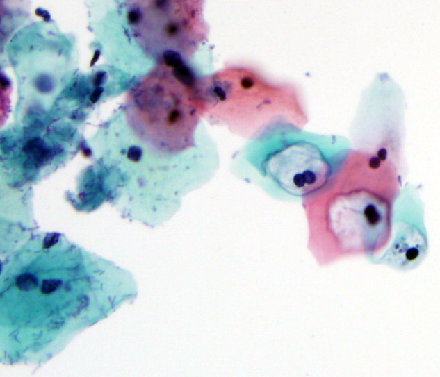 Pap Stain
